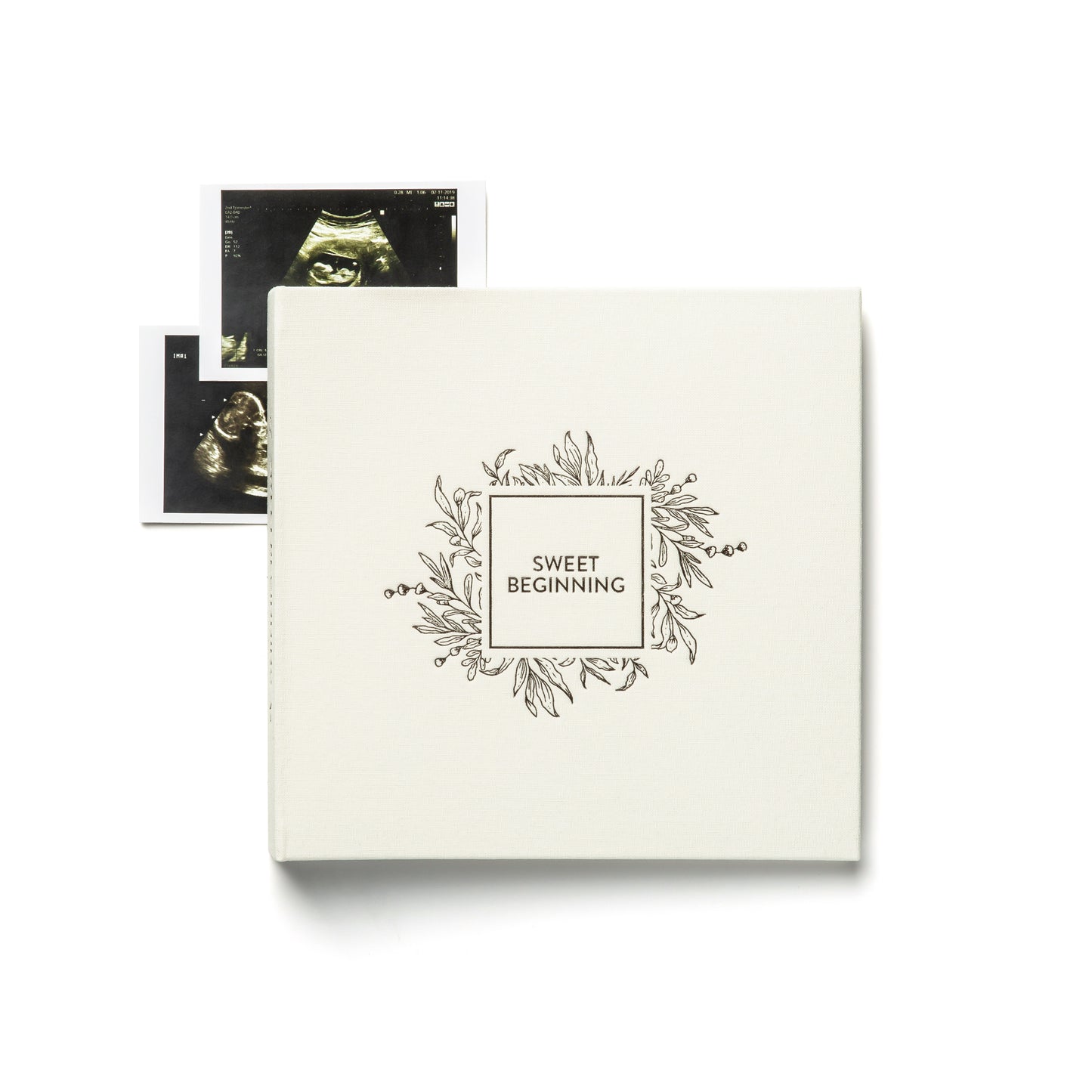 Sweet Beginning Pregnancy Journal