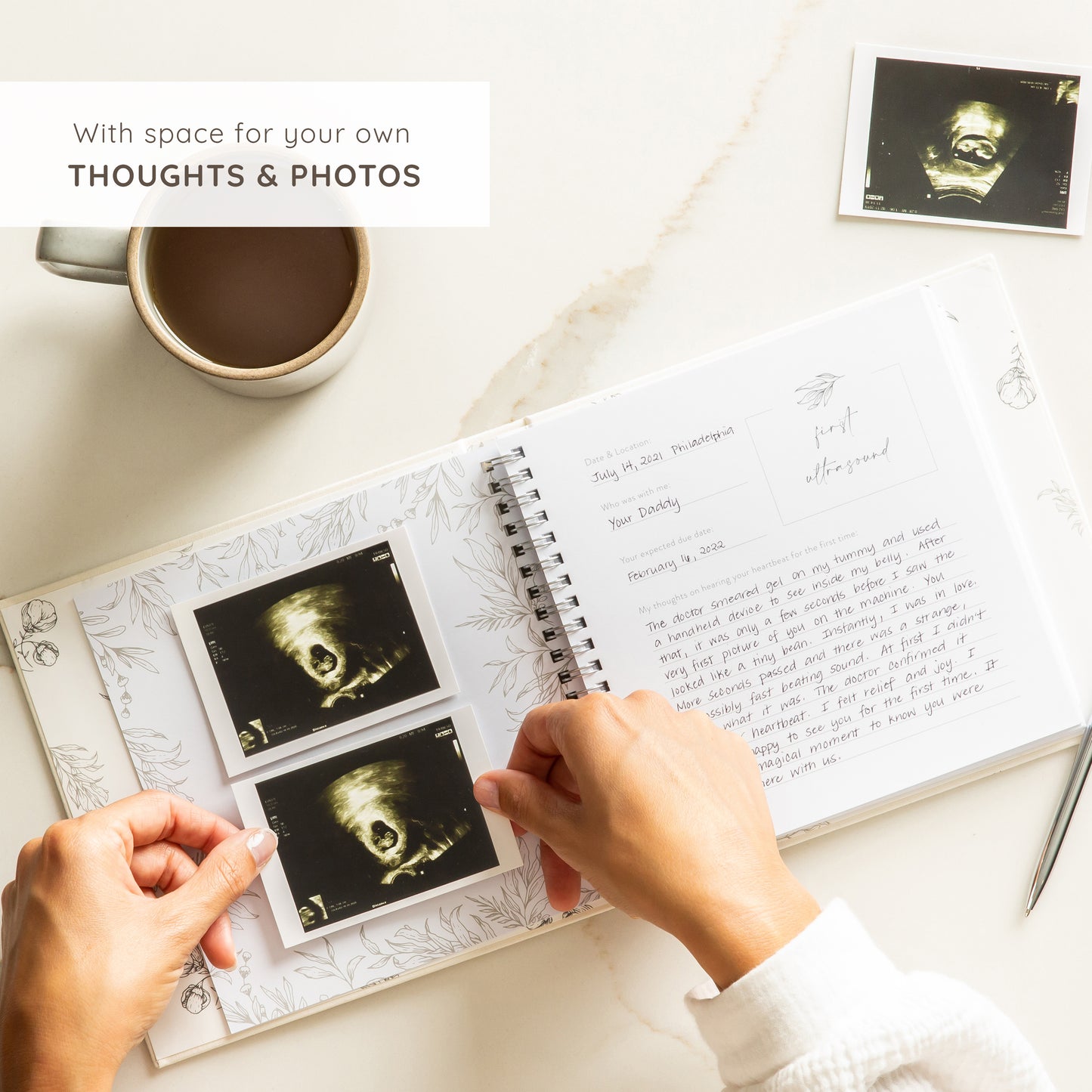 Sweet Beginning Pregnancy Journal